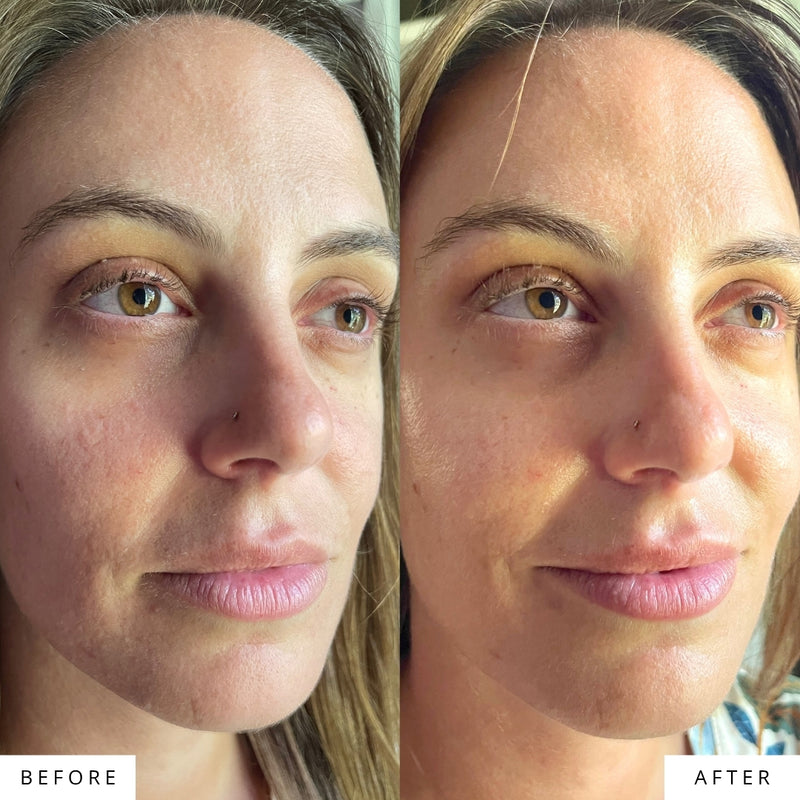 Brighter Tone before and after